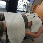 Recorrió el mundo por su endometriosis grave, pensó en la eutanasia y una tecnología española cambió su vida.